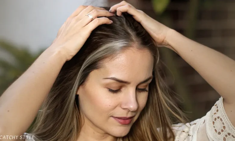 Receding Hairline Women